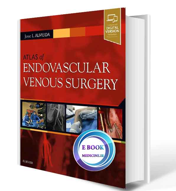 دانلود کتابAtlas of Endovascular Venous Surgery 2019(ORIGINAL PDF) 